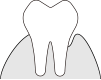 歯科仙川の歯周病
