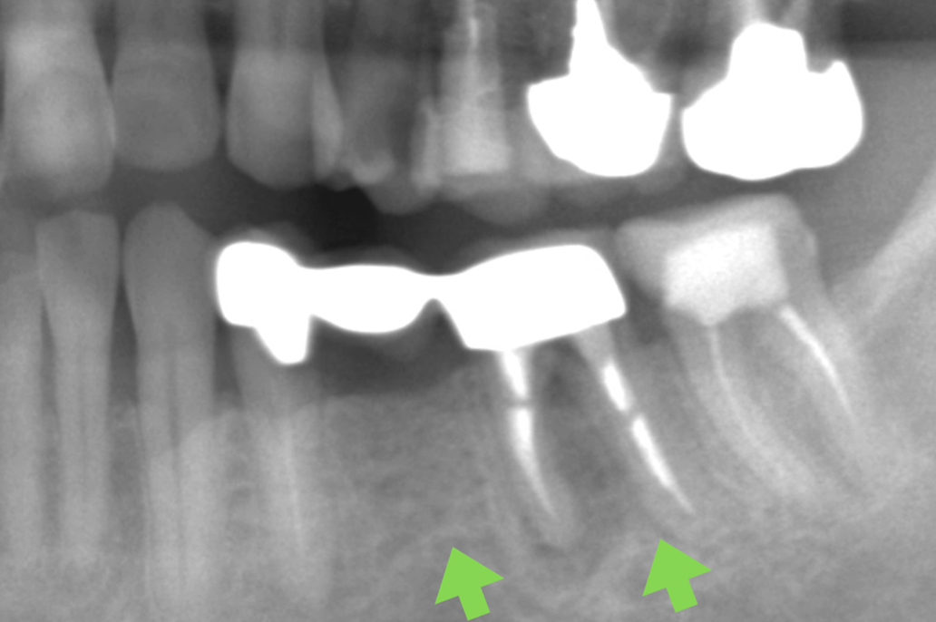 歯科仙川の症例一覧|1BEFORE