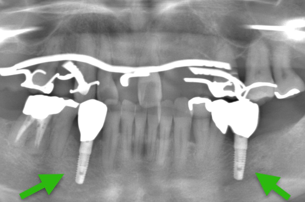 歯科仙川の症例一覧|1AFTER