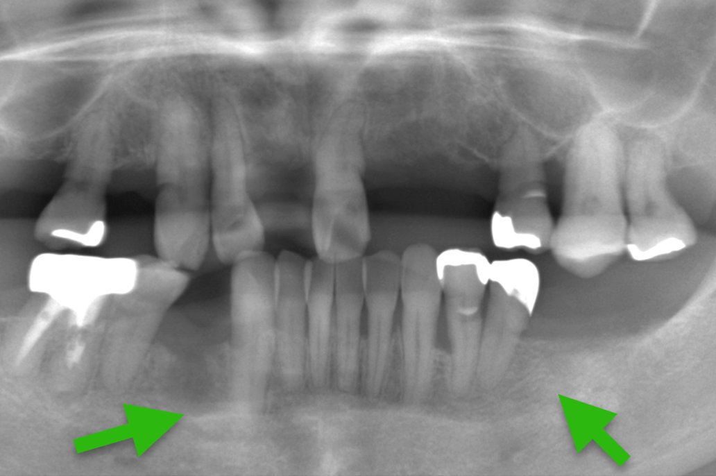歯科仙川の症例一覧|1BEFORE