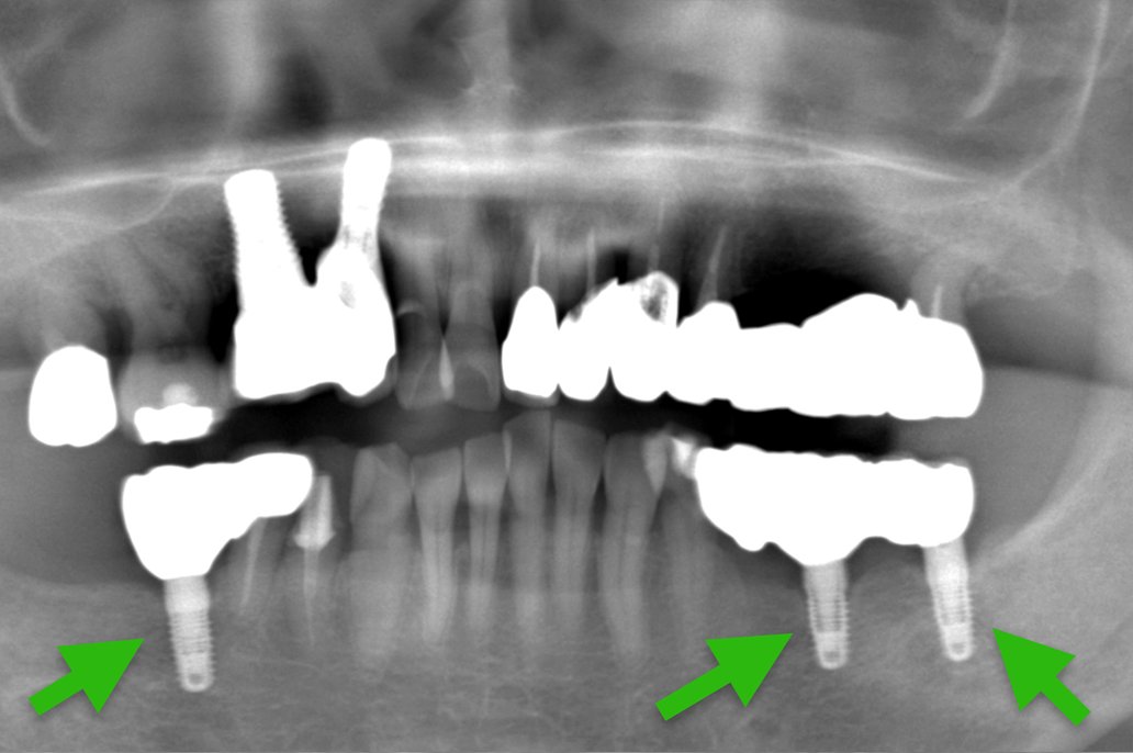 歯科仙川の症例一覧｜1AFTER