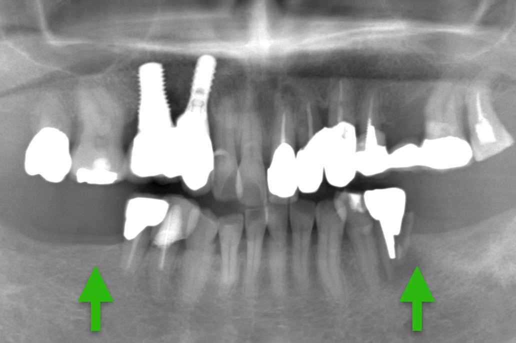 歯科仙川の症例一覧｜1BEFORE