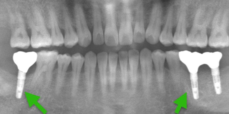 歯科仙川の症例一覧｜1AFTER
