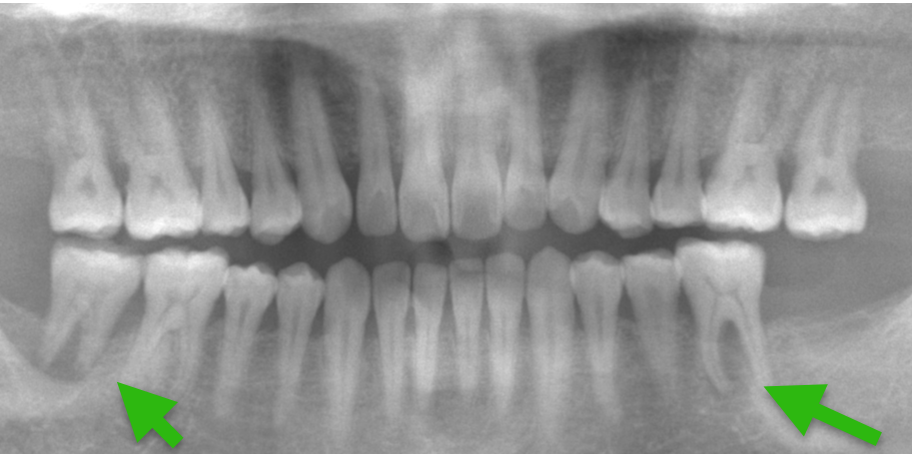 歯科仙川の症例一覧｜1BEFORE
