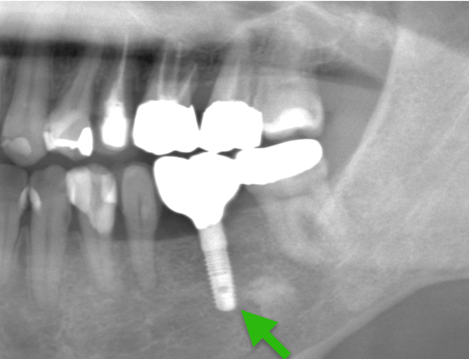 歯科仙川の症例一覧｜1AFTER